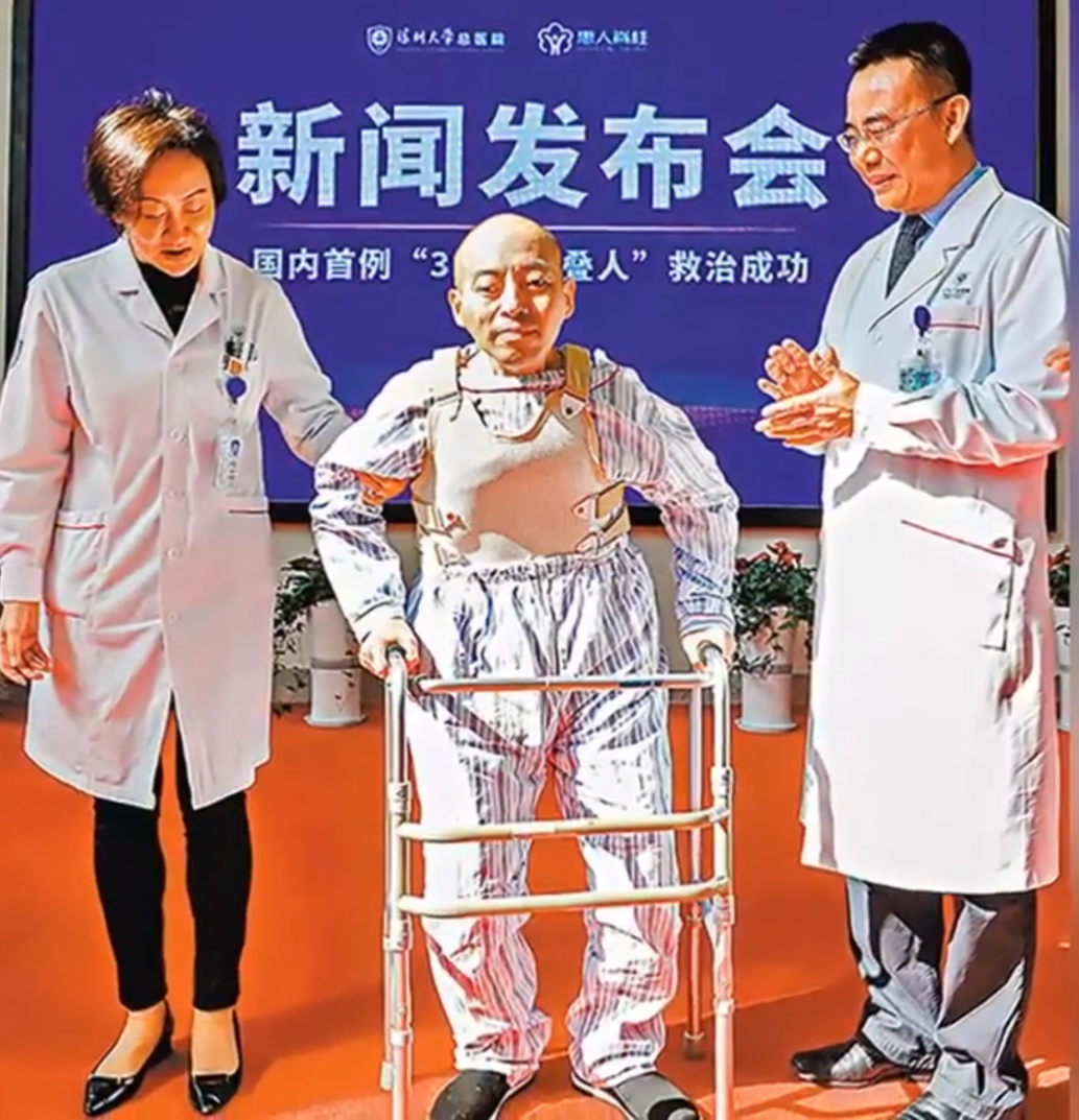 AsiaWire Li is able to move around with a walker.